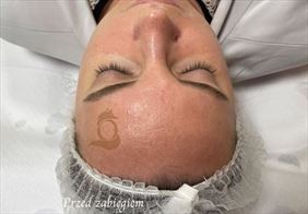 zabiegi kosmetyczne. Natalia Frątczak Wokół Piękna. Poznań