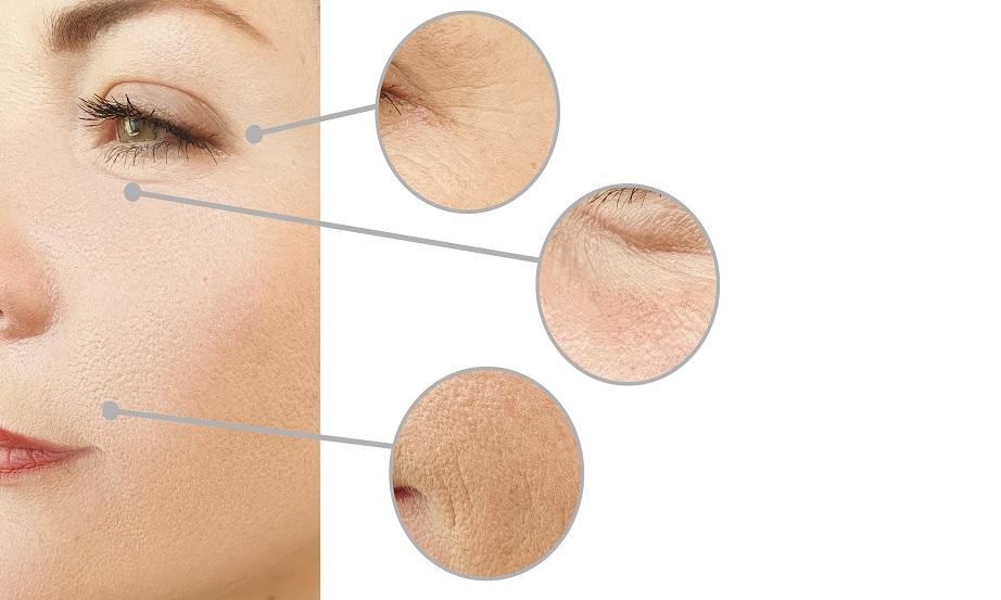 Jak pozbyć się zmarszczek i odmłodnieć wizualnie o kilka lat?