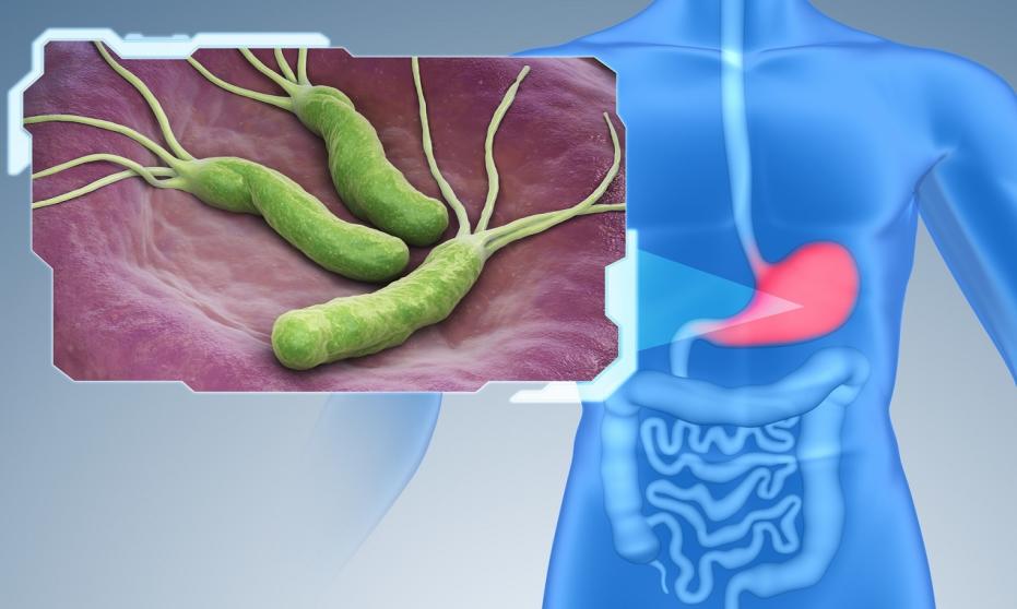 Diagnozowanie Helicobacter pylori