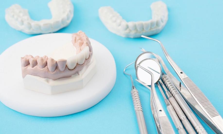 Kiedy mocuje się mosty protetyczne?