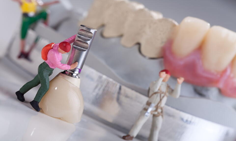 Zalety odbudowy zębów za pomocą implantów Zalety odbudowy zębów za pomocą implantów