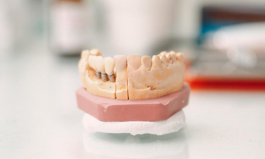 Jak można uzupełnić lukę po ekstrakcji zęba?