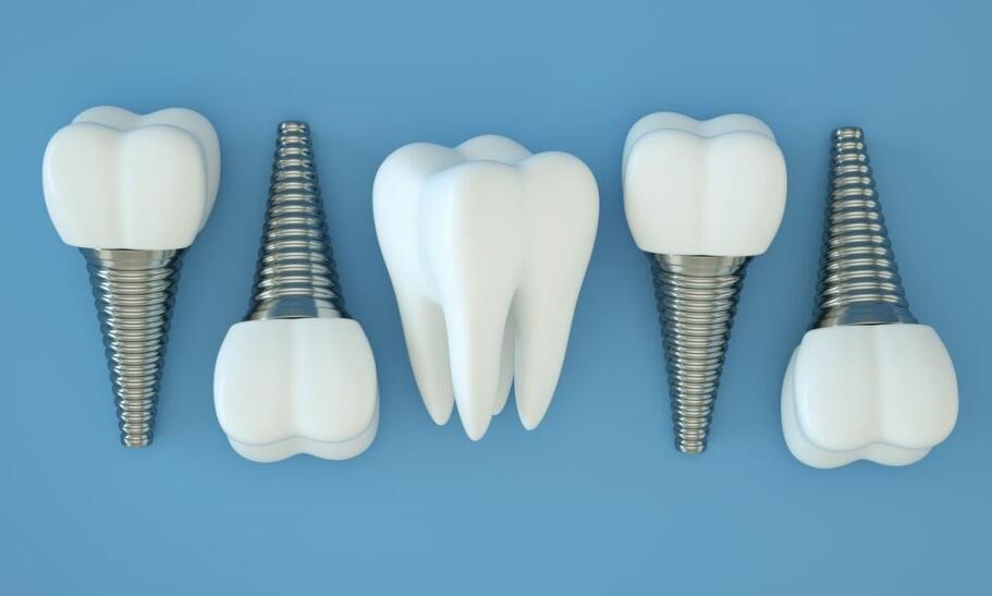 Jakich materiałów używa się do produkcji implantów?