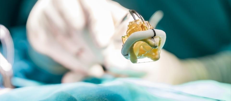 Bioprotezy aortalne szansą dla osób z chorobami serca Bioprotezy aortalne szansą dla osób z chorobami serca