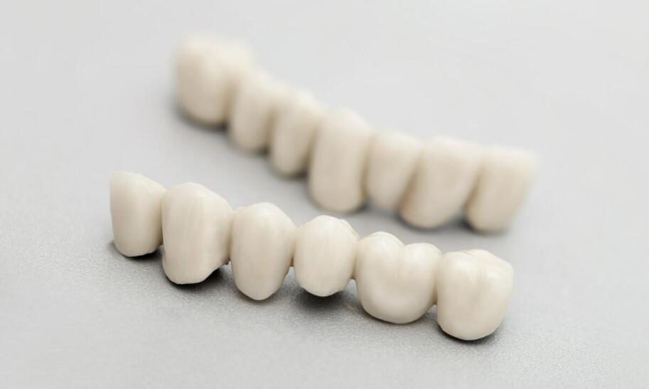 Kiedy warto zdecydować się na korony i mosty protetyczne?