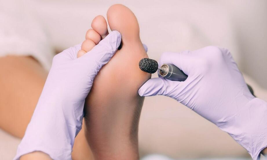 Pedicure leczniczy - kiedy warto się na niego zdecydować? Pedicure leczniczy - kiedy warto się na niego zdecydować?