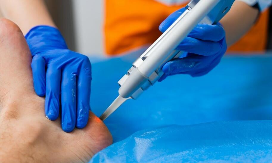 Skleroterapia a zdrowie: jak wpływa na krążenie krwi? Skleroterapia a zdrowie: jak wpływa na krążenie krwi?