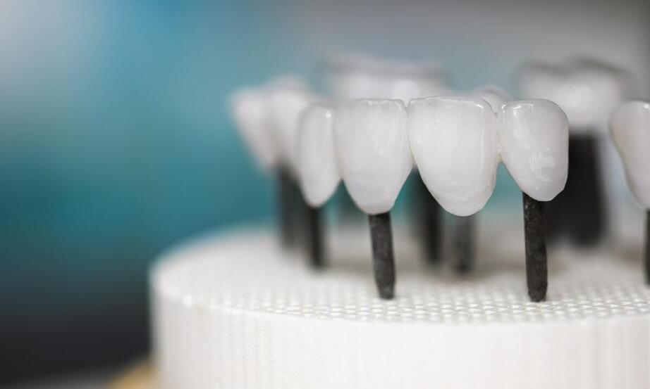 Jakie materiały są najczęściej stosowane w biżuterii nazębnej?