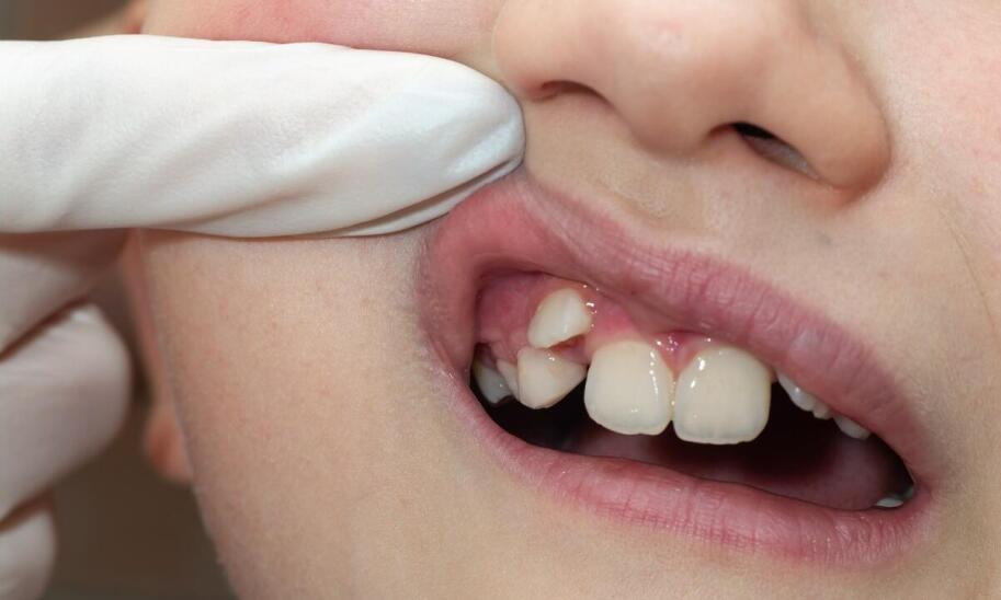 Ruszające się zęby po zdjęciu aparatu - czy jest się czego obawiać?