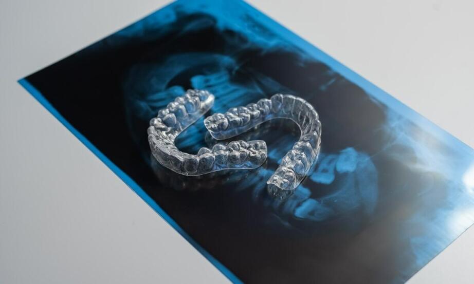 Niewidoczny aparat na zęby a estetyka uśmiechu – jak to działa?