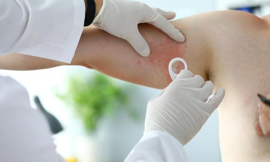 Jakie są najczęstsze infekcje skóry i jak je leczyć u dermatologa? Jakie są najczęstsze infekcje skóry i jak je leczyć u dermatologa?