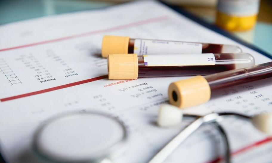 Kiedy warto wykonać badania laboratoryjne krwi? Kiedy warto wykonać badania laboratoryjne krwi?