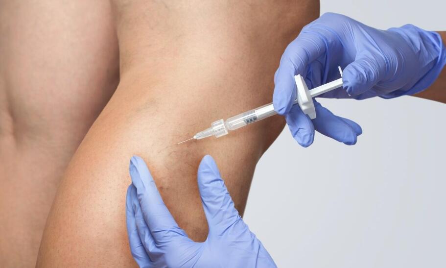 Jak skleroterapia może poprawić komfort życia pacjentów z żylakami? Jak skleroterapia może poprawić komfort życia pacjentów z żylakami?