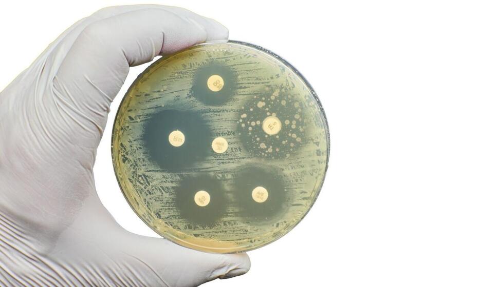Jakie są zalety stosowania flory bakteryjnej w biologicznych oczyszczalniach? Jakie są zalety stosowania flory bakteryjnej w biologicznych oczyszczalniach?