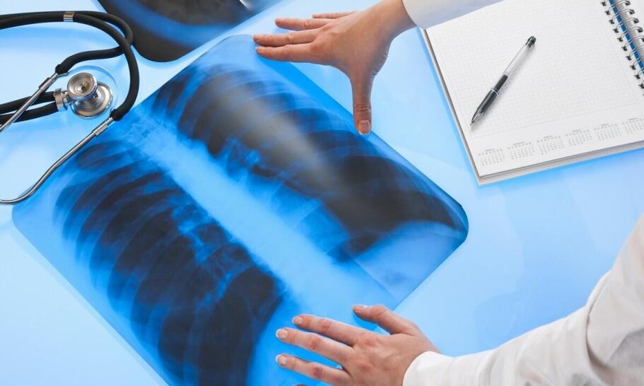 Rentgen w diagnostyce chorób układu pokarmowego: jakie badania są możliwe? Rentgen w diagnostyce chorób układu pokarmowego: jakie badania są możliwe?