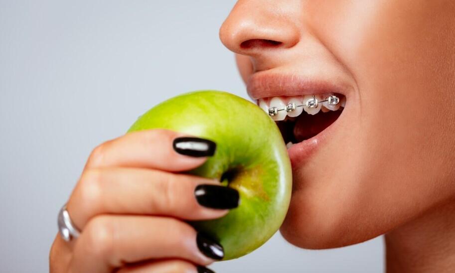 Aparat na zęby: przegląd cen w kontekście różnych rodzajów leczenia ortodontycznego