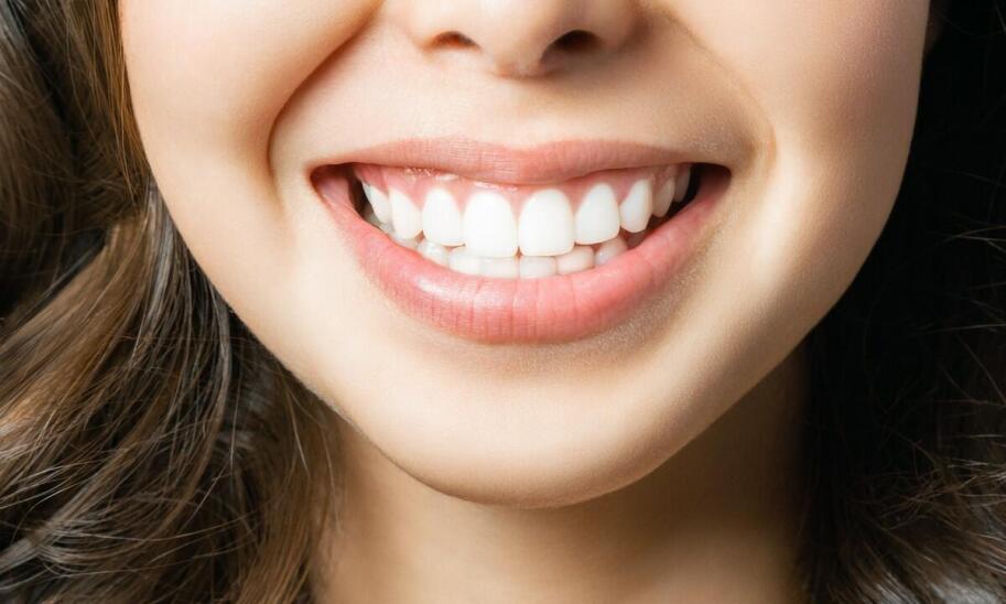 Jak długo utrzymuje się efekt wybielania zębów u dentysty?