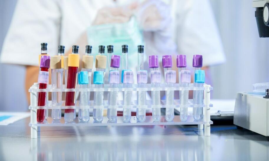 Jakie badania diagnostyczne są kluczowe w leczeniu chorób wewnętrznych?