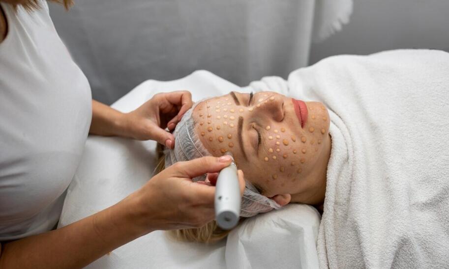 Skuteczność mezoterapii igłowej w redukcji widoczności naczynek na twarzy