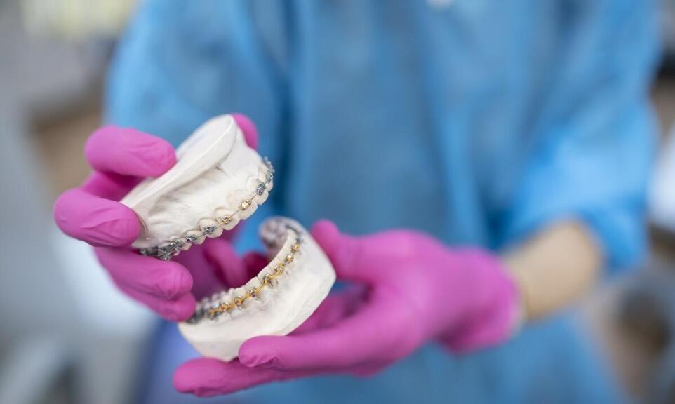 Kiedy ruchome aparaty ortodontyczne sprawdzają się lepiej od stałych?