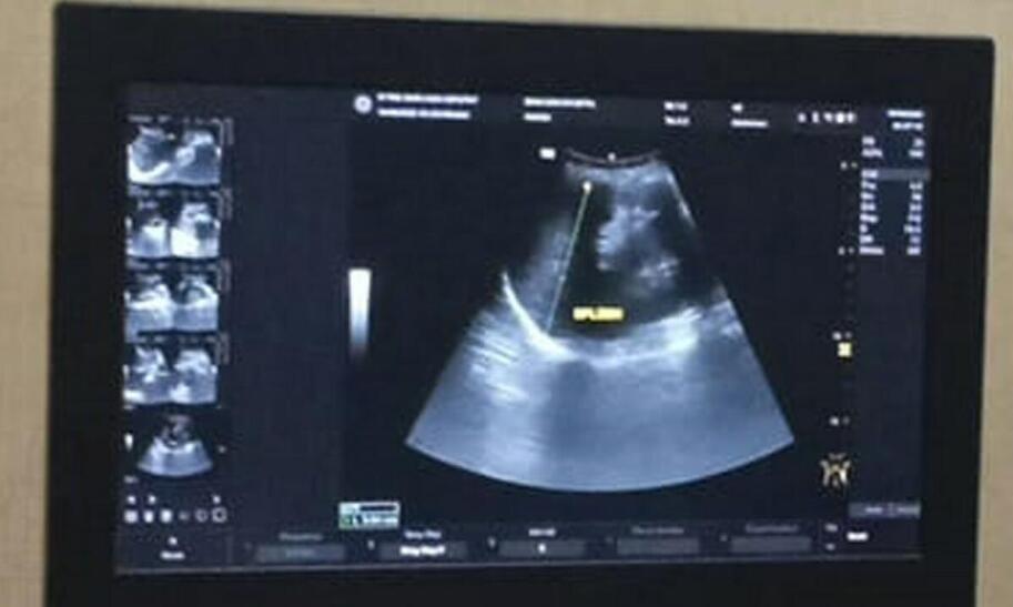 Świadczenia dla kobiet w ciąży bez pracy w 2025 roku