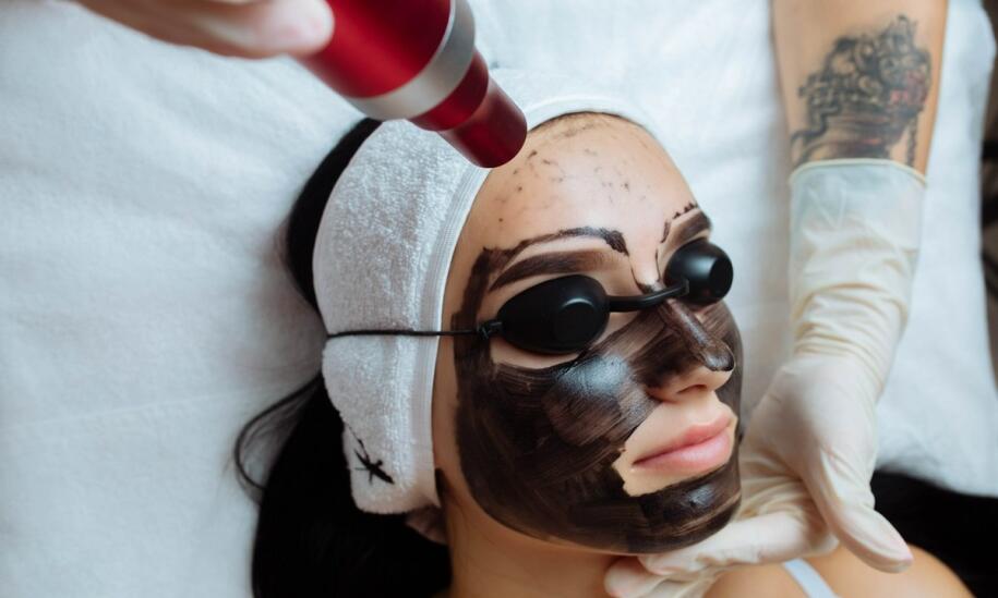 Porównanie węglowego peelingu laserowego z innymi metodami oczyszczania skóry