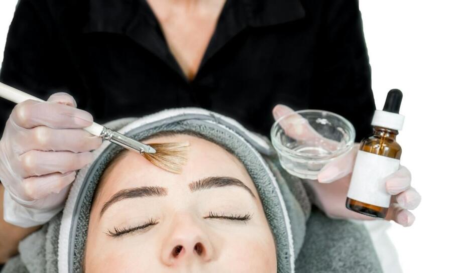 Usuwanie zaskórników: porównanie salicylowego peelingu i innych metod