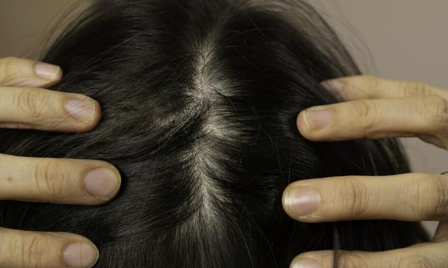 Jak dbać o włosy, żeby były gęste?