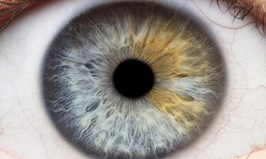 Ile dioptrii ma zdrowe oko człowieka?