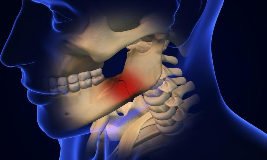 Ile wynosi odszkodowanie za skręcenie i naderwanie stawu skokowego?