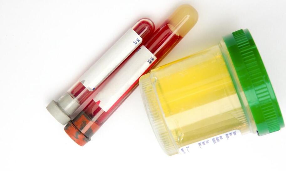 Badanie krwi co zrobić przed i po analizie