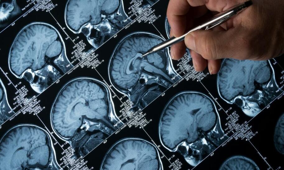 Torbiel pajęczynówki – co to jest i jakie daje objawy