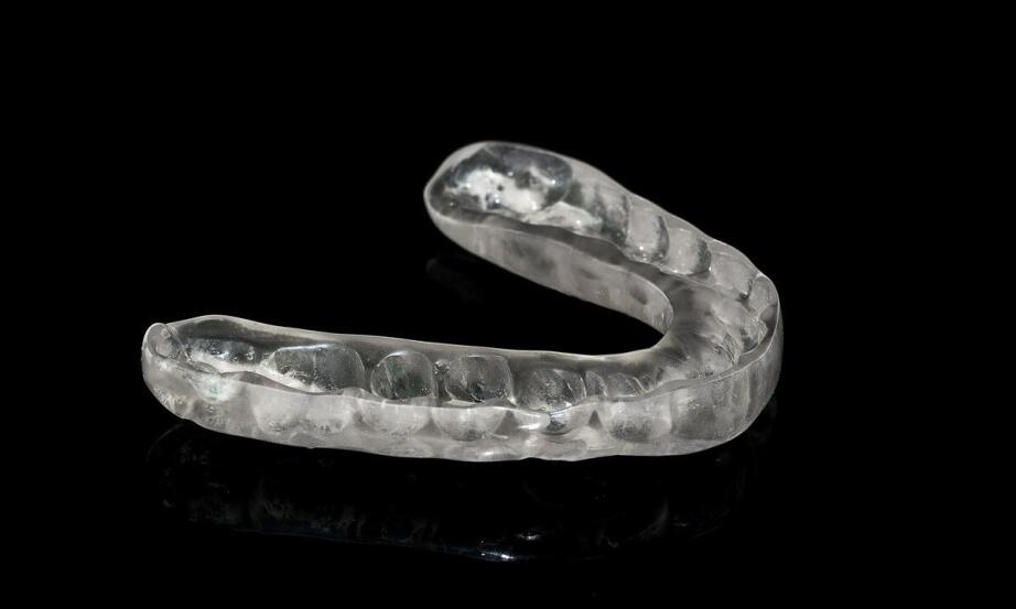 Jakie są kluczowe korzyści z noszenia nakładek ortodontycznych?