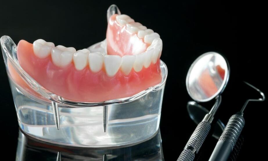 Jak estetyka zgryzu wpływa na wybór zębowych protez?