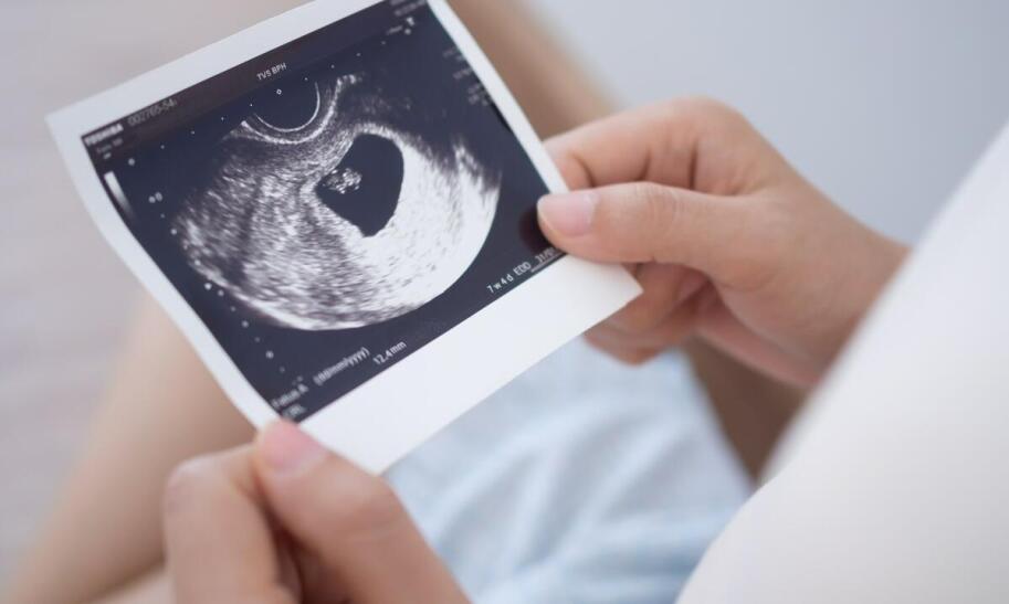 Jak bezpiecznie puszczać muzykę dziecku w brzuchu