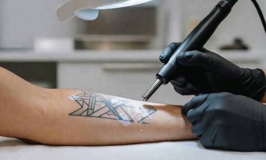 Jak laser pikosekundowy rozbija pigment i co dzieje się ze skórą po zabiegu