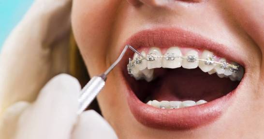 Czy leczenie ortodontyczne boli?