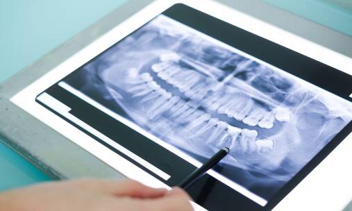 Diagnostyka stomatologiczna - badania radiologiczne