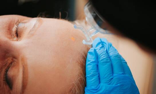 Współczesne metody leczenia łysienia i wypadania włosów