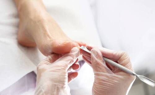 Pedicure kosmetyczny i medyczny - różnice i zalety każdego z nich