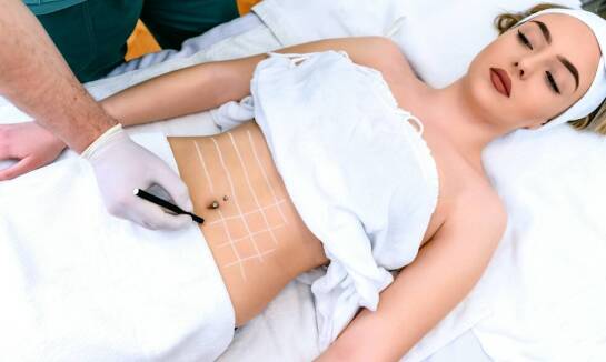 Liposukcja: jakie są różnice między metodami tradycyjnymi a laserowymi?
