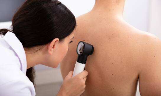 Jak przebiega zabieg usuwania kaszaków w dermatologii estetycznej?