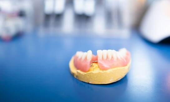 Czym jest proteza na implantach i kiedy się warto na nią zdecydować?