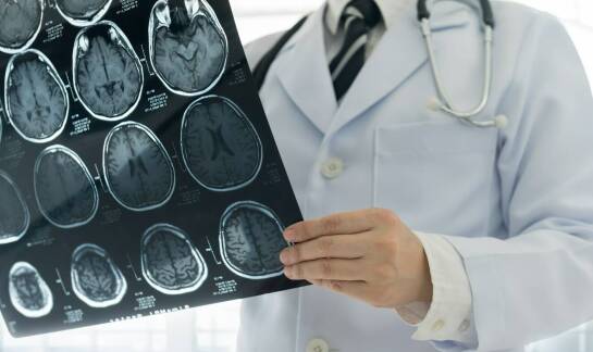 Dlaczego warto skonsultować się z neurologiem w przypadku przewlekłego bólu?