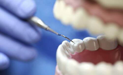 Dlaczego regularne wizyty u periodontologa są niezbędne dla zdrowia jamy ustnej?
