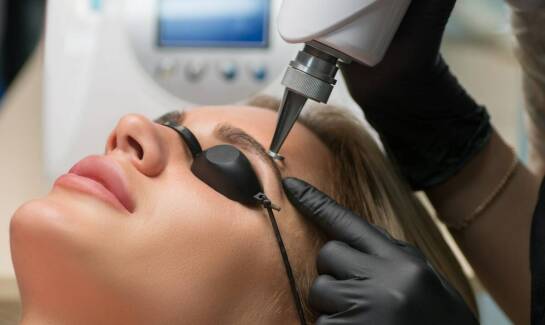 Jakie są różnice między usuwaniem znamion laserem a innymi metodami?