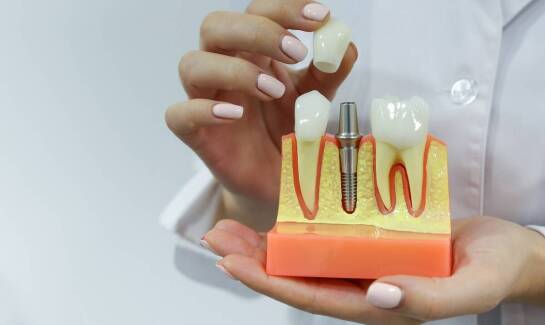 Rodzaje implantów zębowych – czym się różnią?