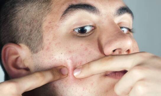 Jakie są najczęstsze przyczyny wizyt u dermatologa?