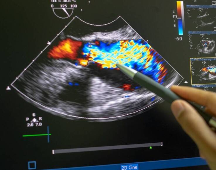 Znaczenie szybkiej diagnozy w poradni kardiologicznej