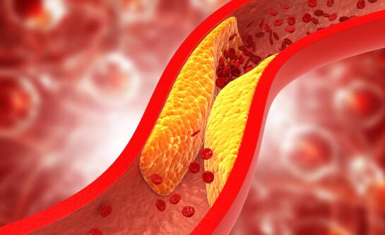 Czy słodycze podwyższają cholesterol i jak temu zapobiec?
